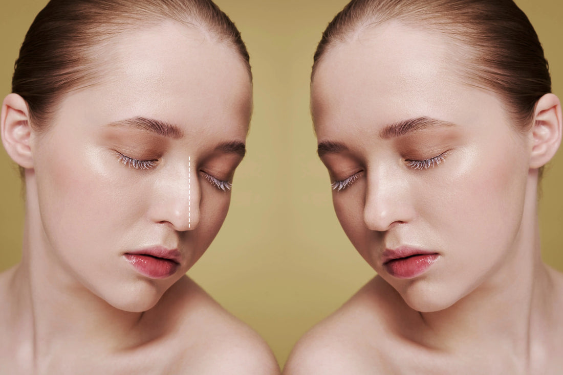 Liquid-Nose-Job-mehr-Was-Revolax-Deep-wirklich-kann WIR Aesthetics