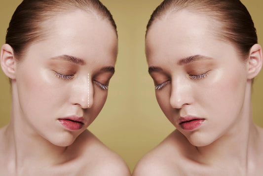 Liquid-Nose-Job-mehr-Was-Revolax-Deep-wirklich-kann WIR Aesthetics