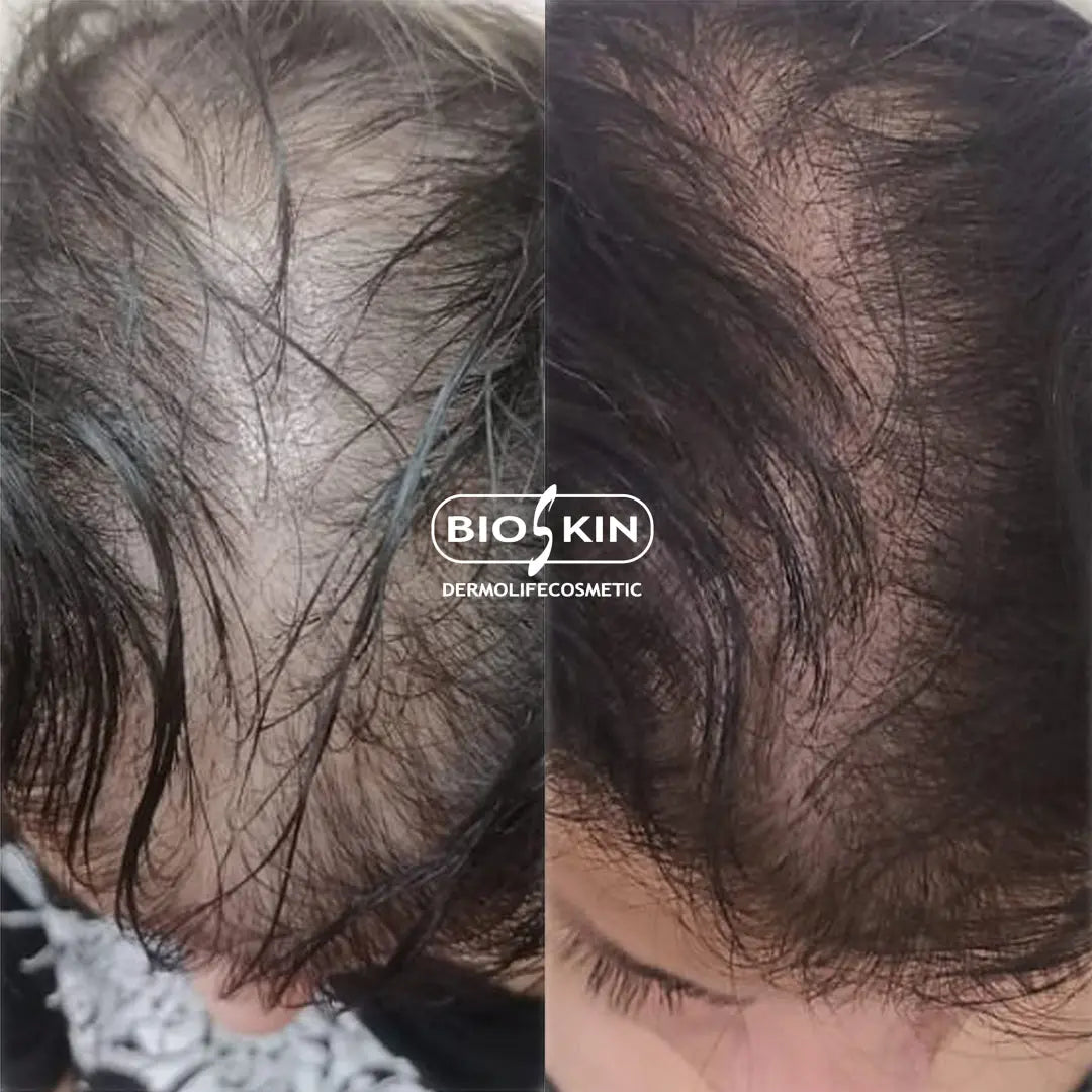 BSK9 Hairpro