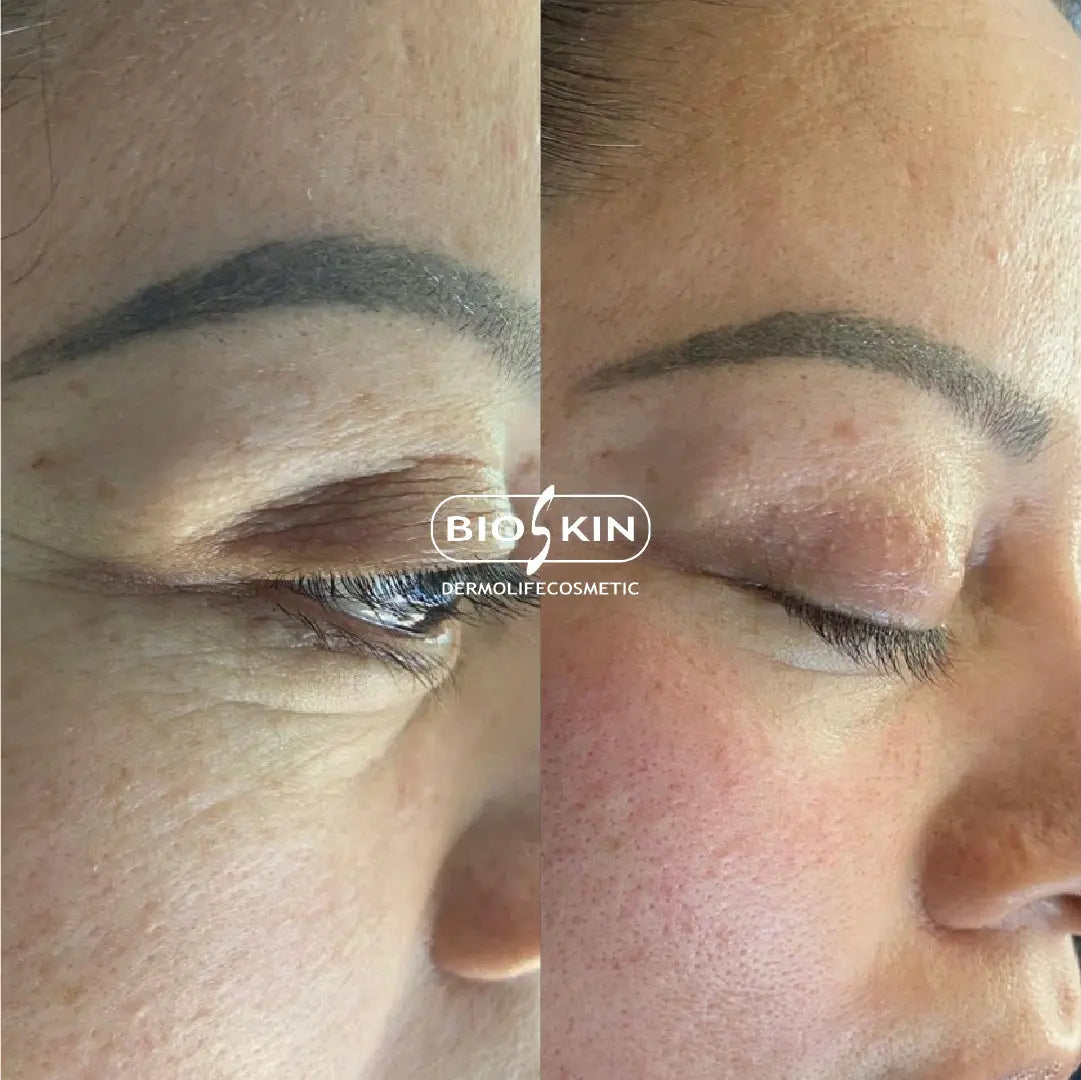 BioSkin BSK95 Eye Contour Pro