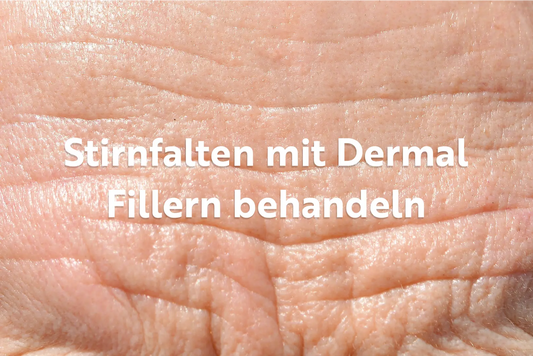Stirnfalten mit Dermalfillern behandeln: Injektionstechniken