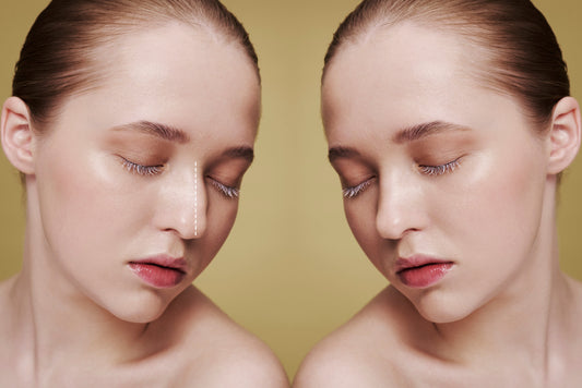 Liquid Nose Job & mehr: Was Revolax Deep wirklich kann