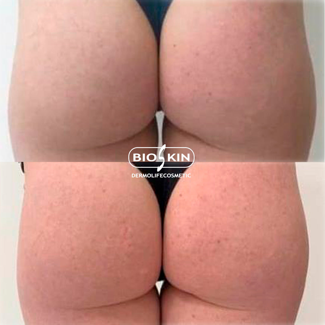 BioSkin BSK28 Butt-up Pro 