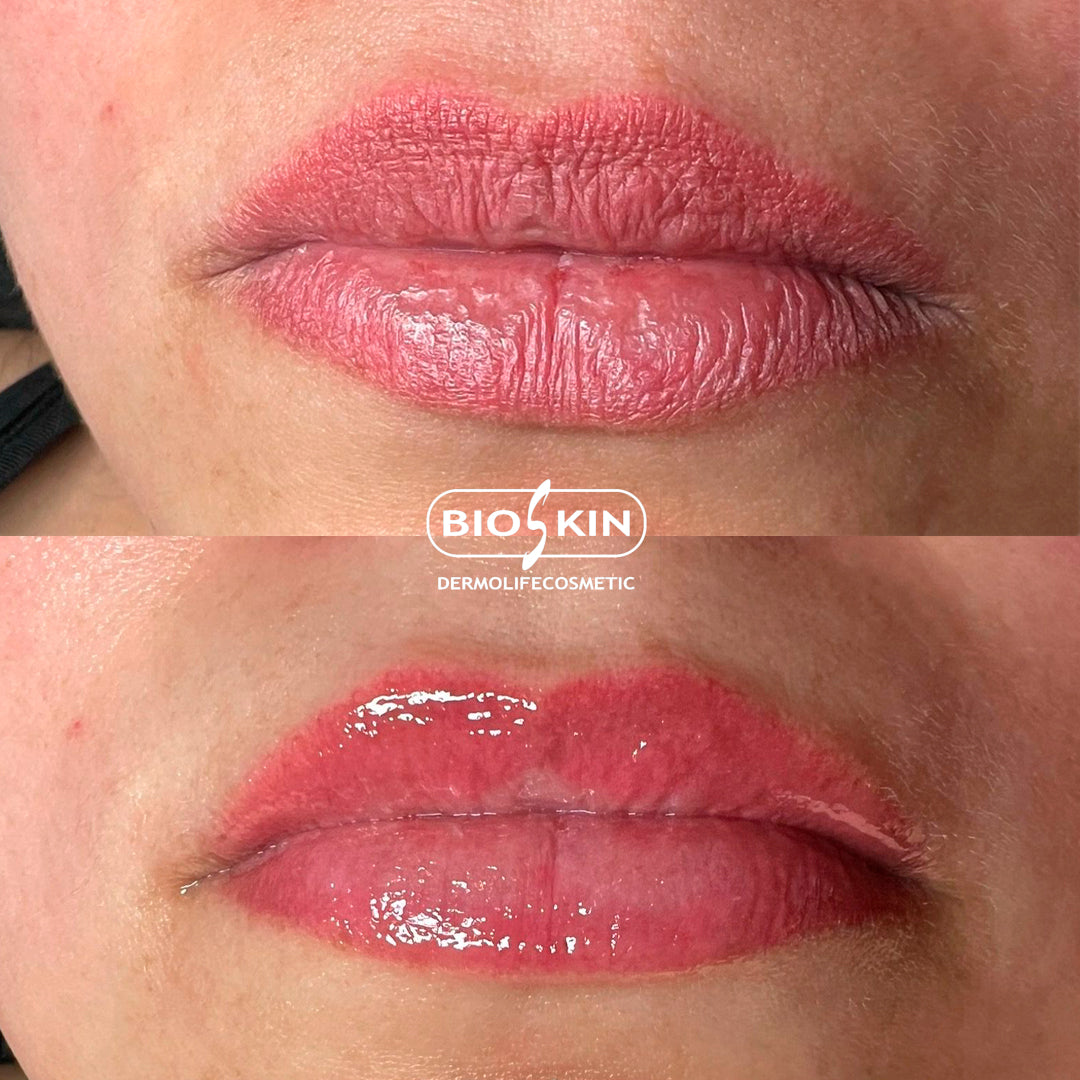 BioSkin BSK31 Lips Shine Pro 