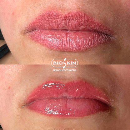 BioSkin BSK31 Lips Shine Pro 