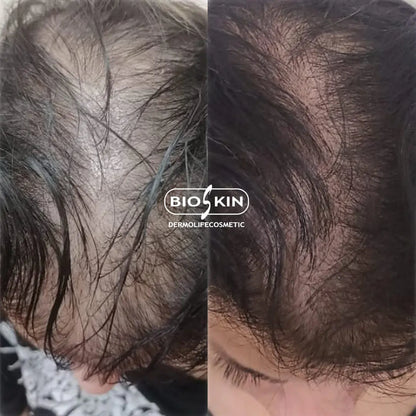 BSK9 Hairpro 