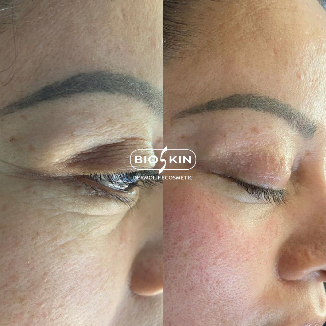 BioSkin BSK95 Eye Contour Pro 