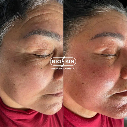 BioSkin BSK29 Bioplax Pro 